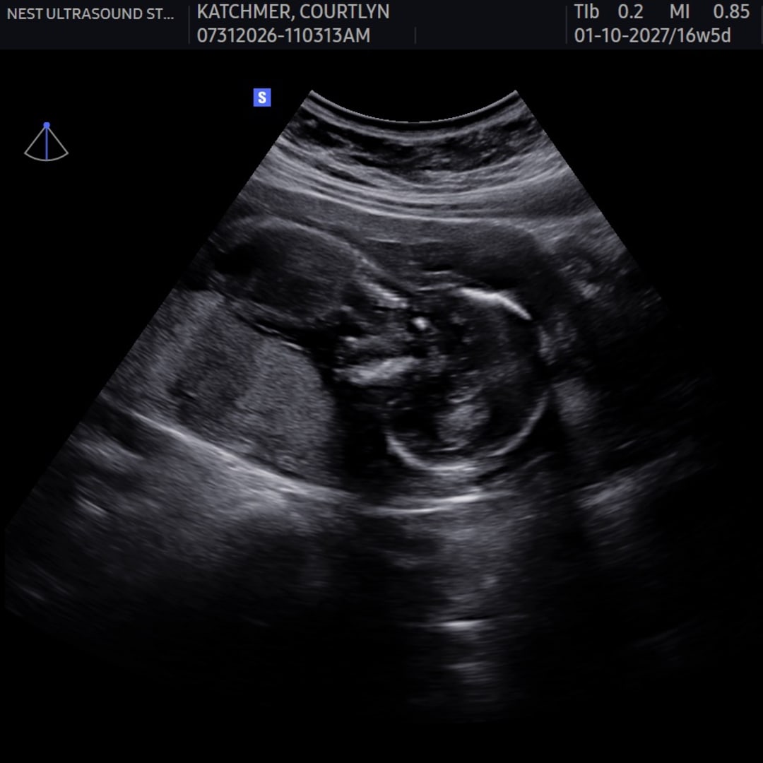 Photo shared by Courtlyn for their Babylist baby registry.