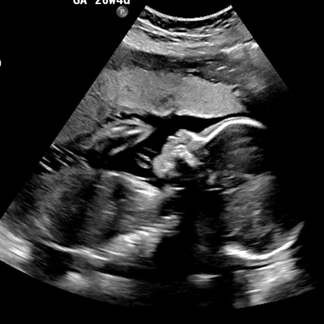 Photo shared by Reagan for their Babylist baby registry.