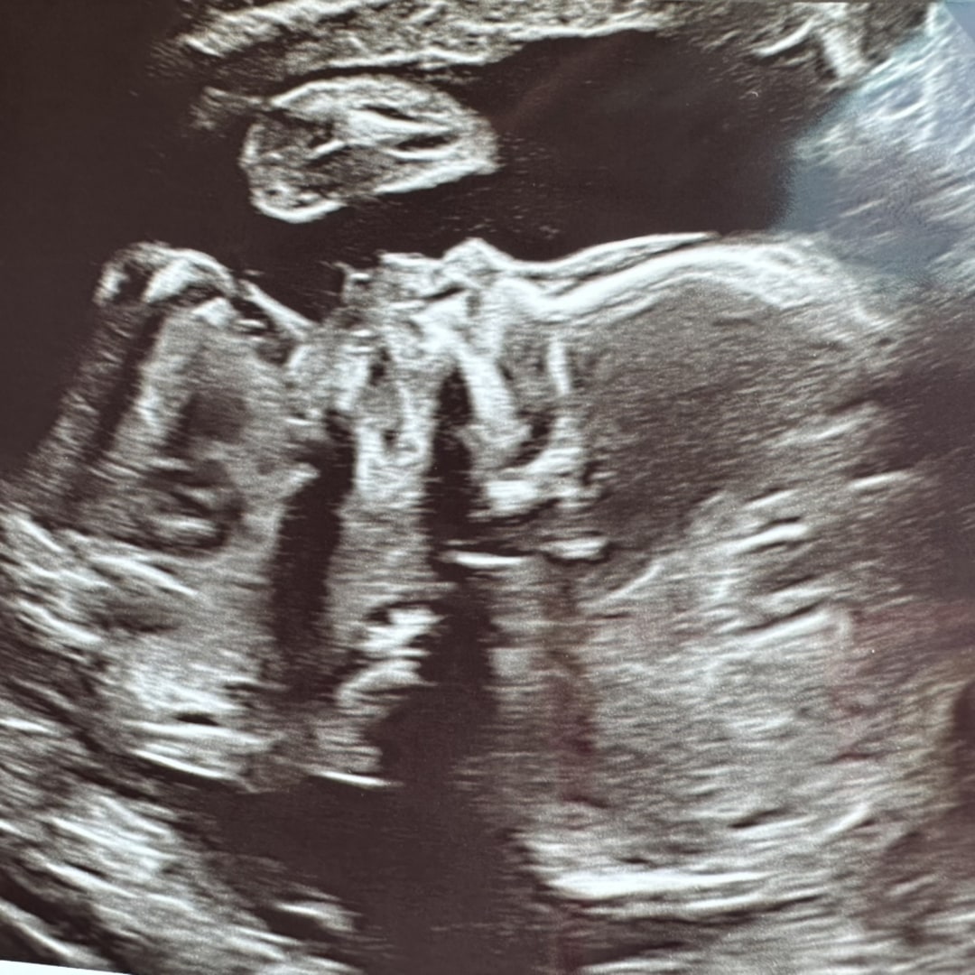 Photo shared by Gabrielle for their Babylist baby registry.