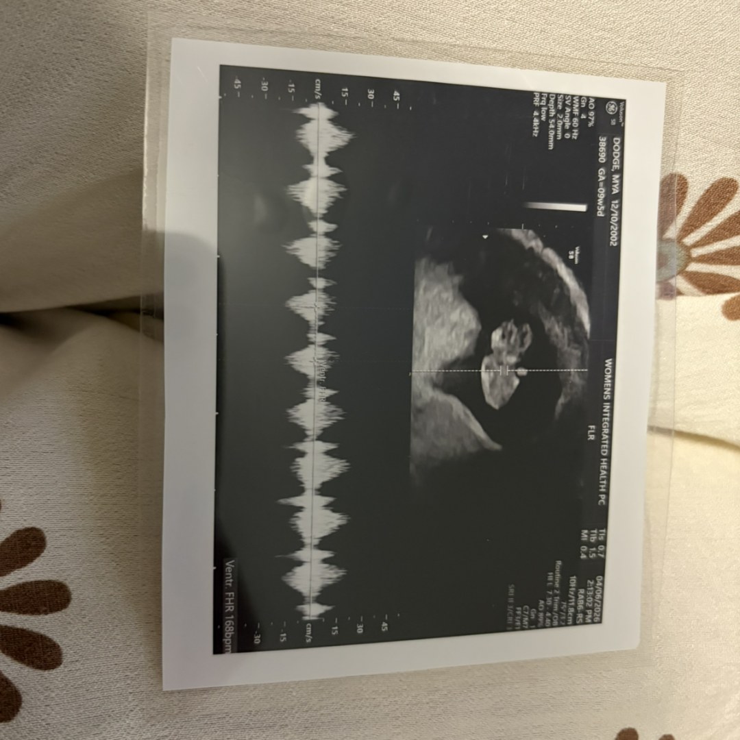 Photo shared by Mya for their Babylist baby registry.