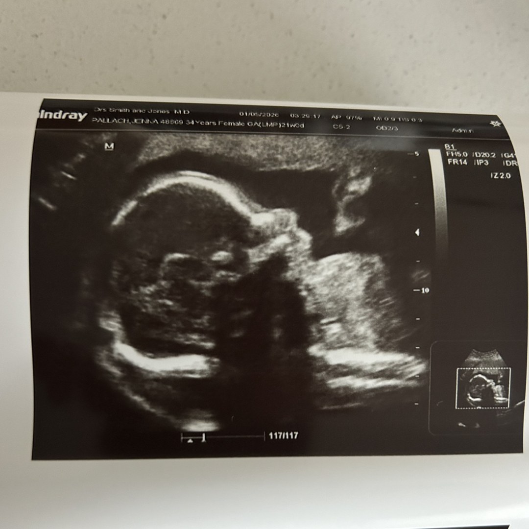 Photo shared by Jenna for their Babylist baby registry.