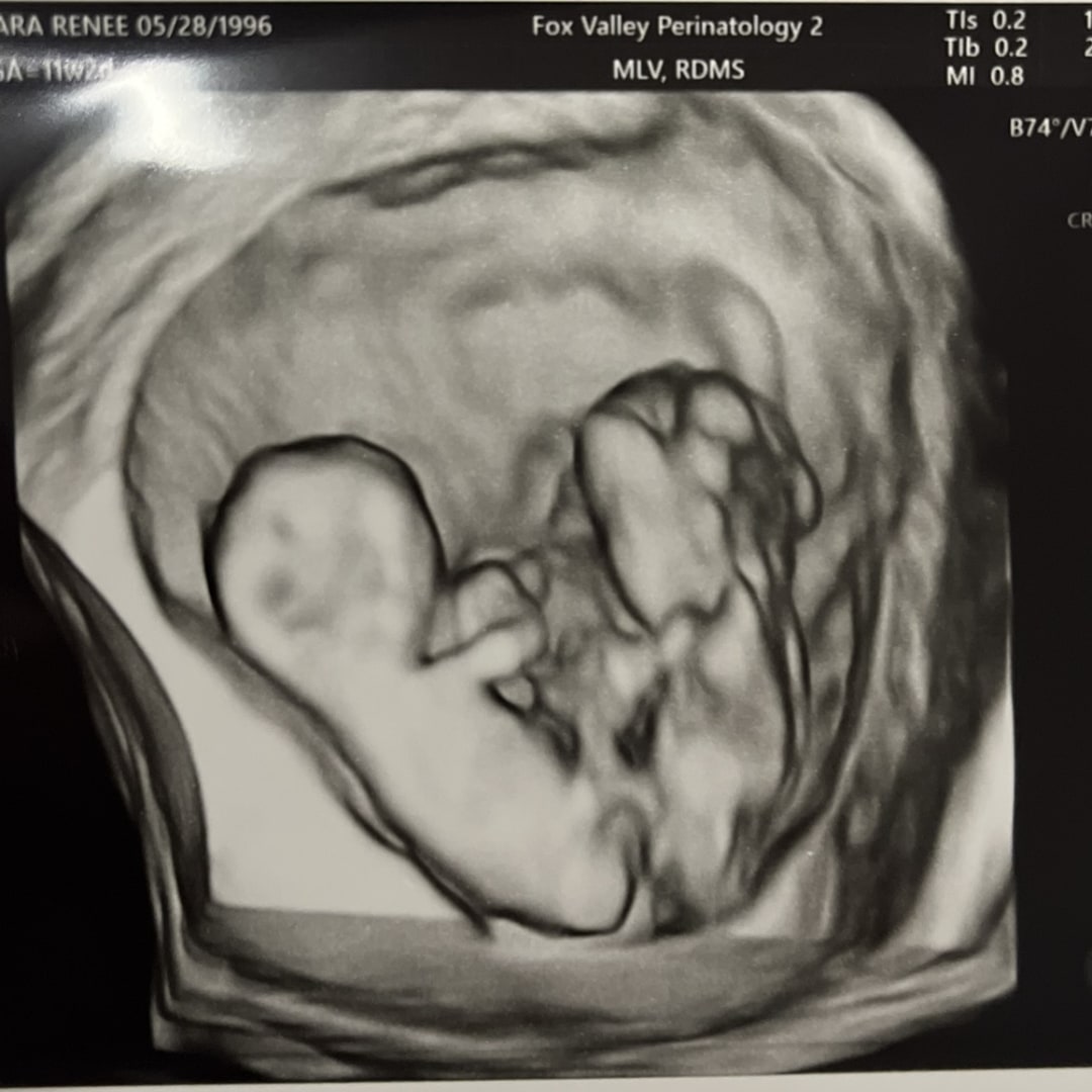 Photo shared by Kara for their Babylist baby registry.