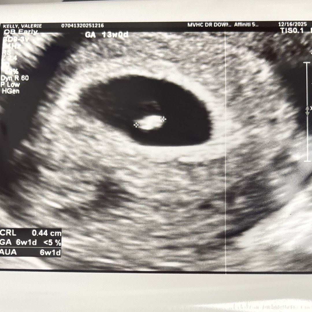 Photo shared by Valerie for their Babylist baby registry.