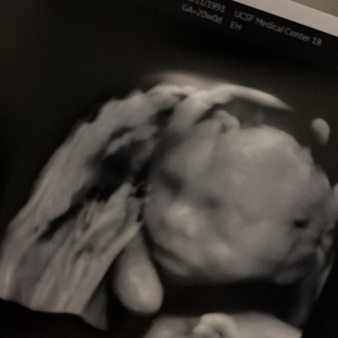 Photo shared by Kayla & Travis for their Babylist baby registry.