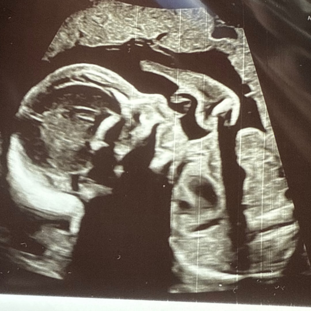 Photo shared by Jade for their Babylist baby registry.