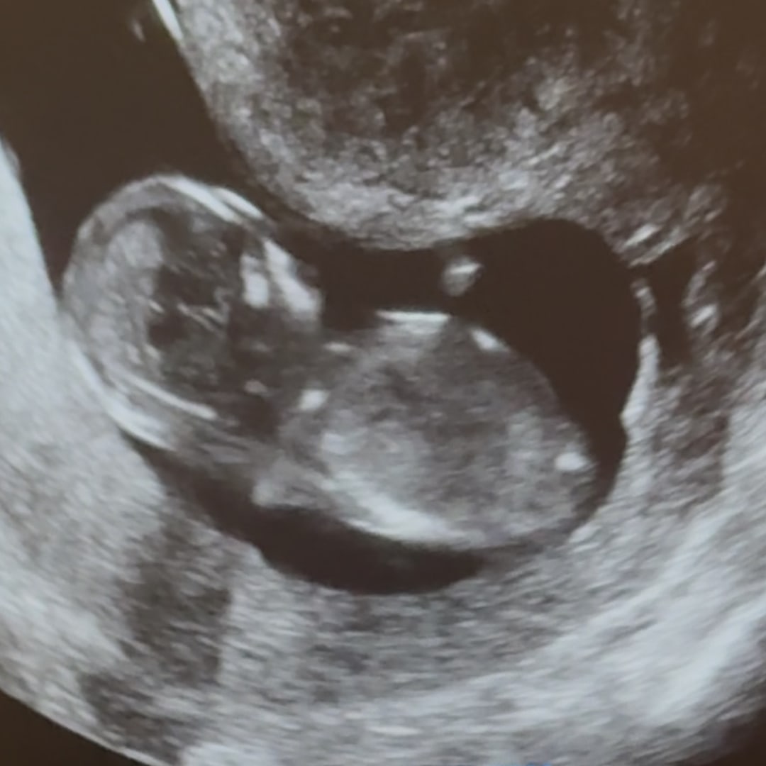 Photo shared by Elexies for their Babylist baby registry.