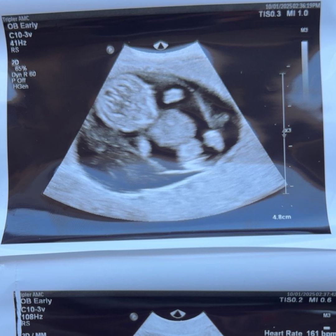 Photo shared by Ellee for their Babylist baby registry.