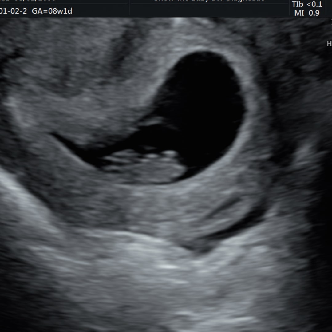 Photo shared by Grace for their Babylist baby registry.