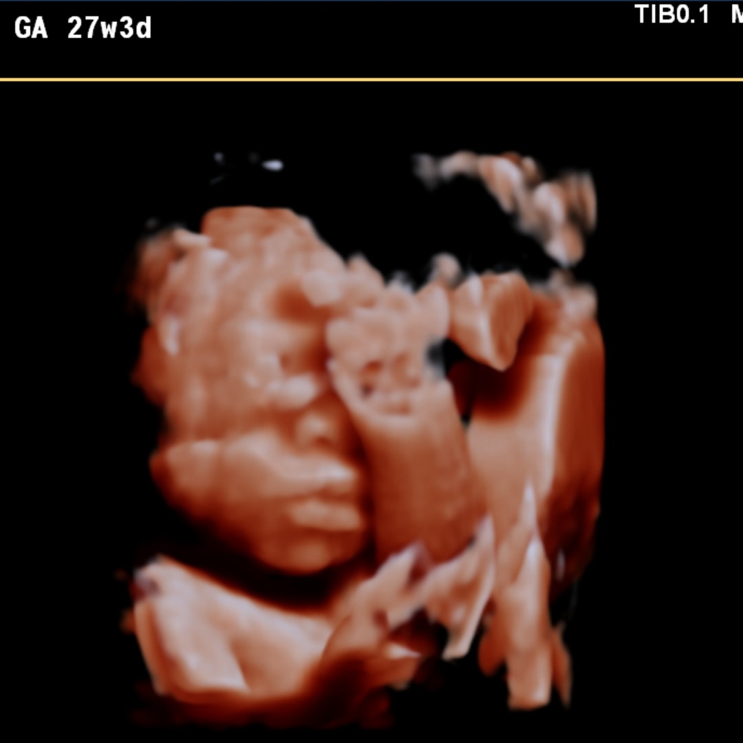 Photo shared by Kaela for their Babylist baby registry.