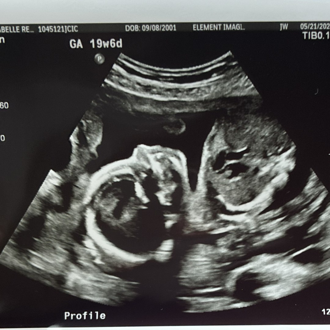 Photo shared by Isabelle for their Babylist baby registry.