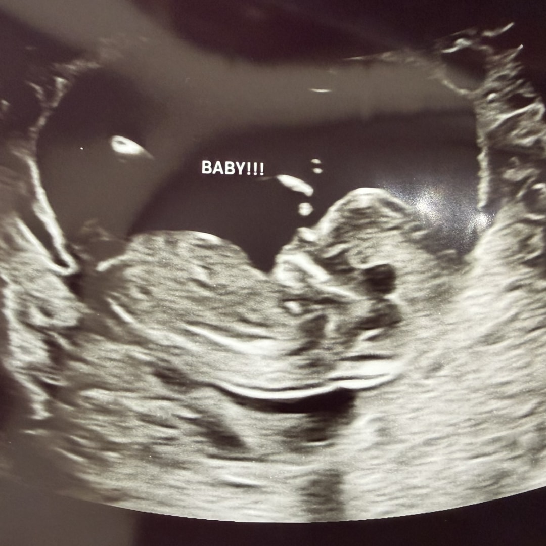 Photo shared by Rachel for their Babylist baby registry.