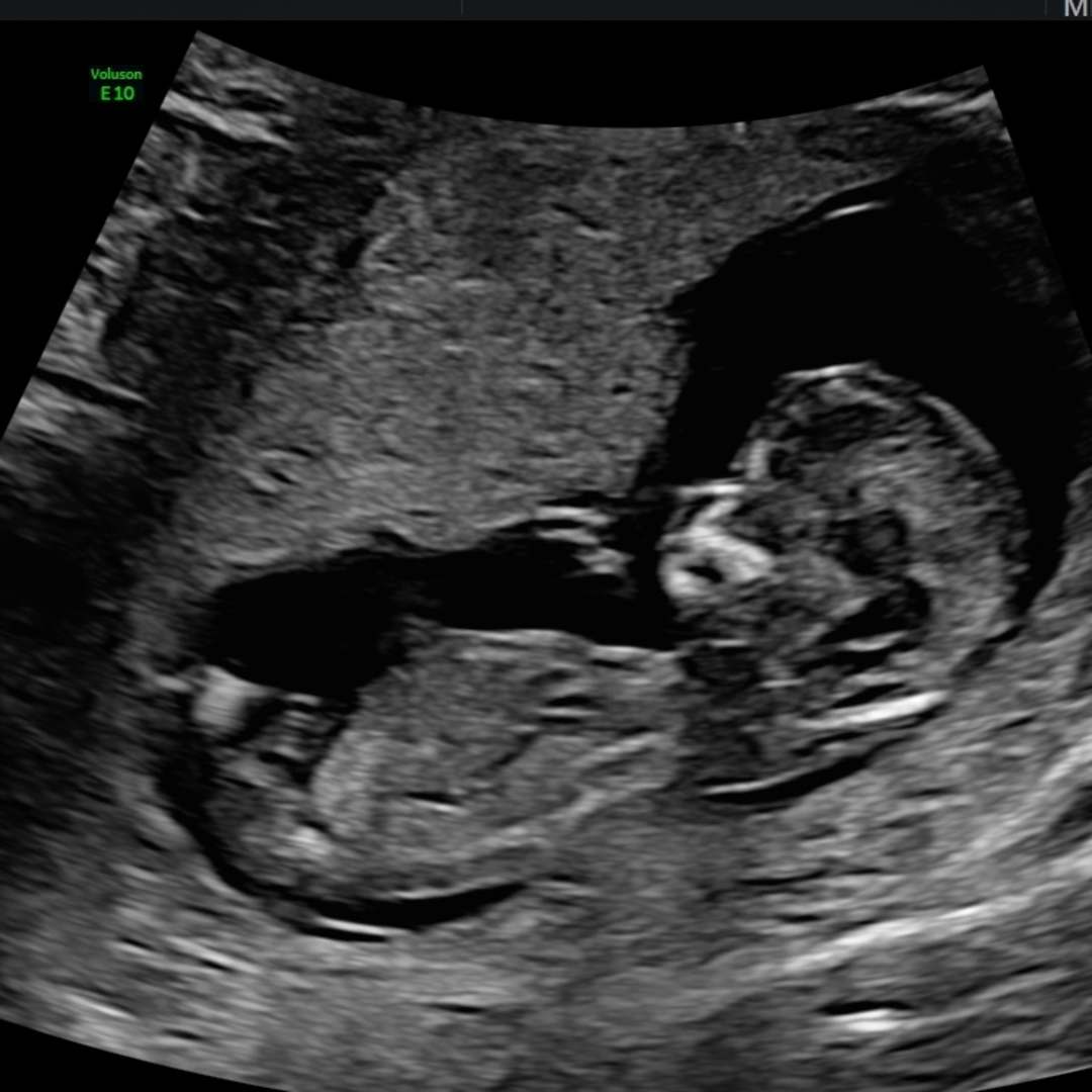 Photo shared by Hannah for their Babylist baby registry.