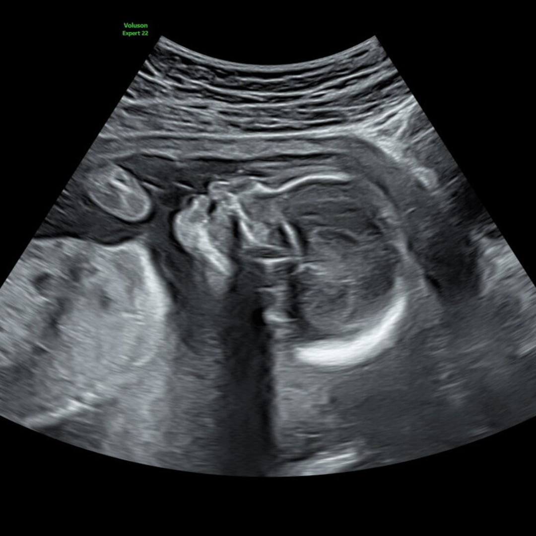 Photo shared by Edith for their Babylist baby registry.