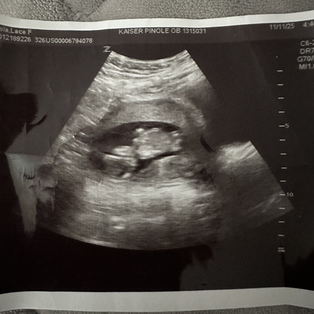 Photo shared by Robin for their Babylist baby registry.