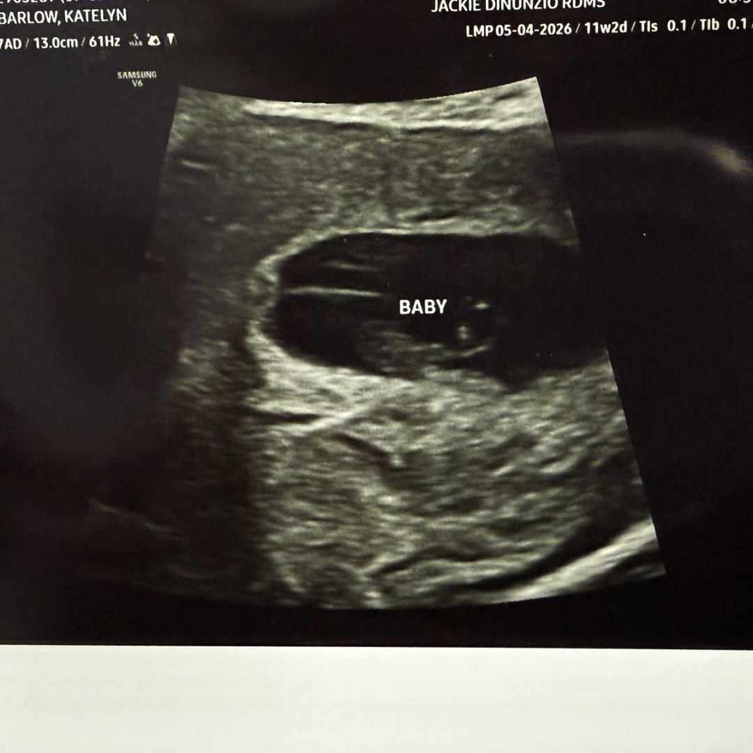 Photo shared by Katelyn for their Babylist baby registry.