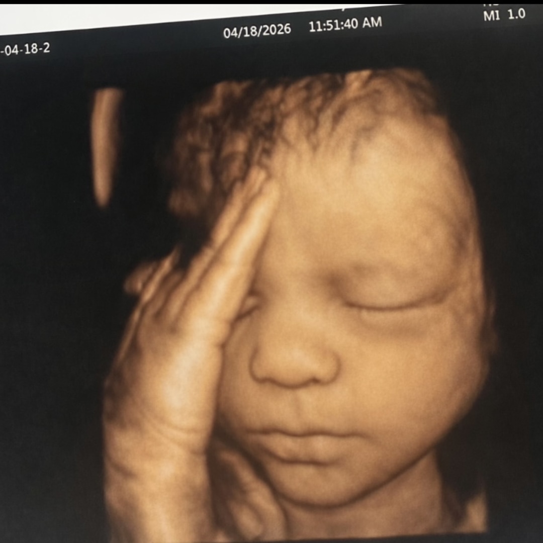 Photo shared by Endacha for their Babylist baby registry.