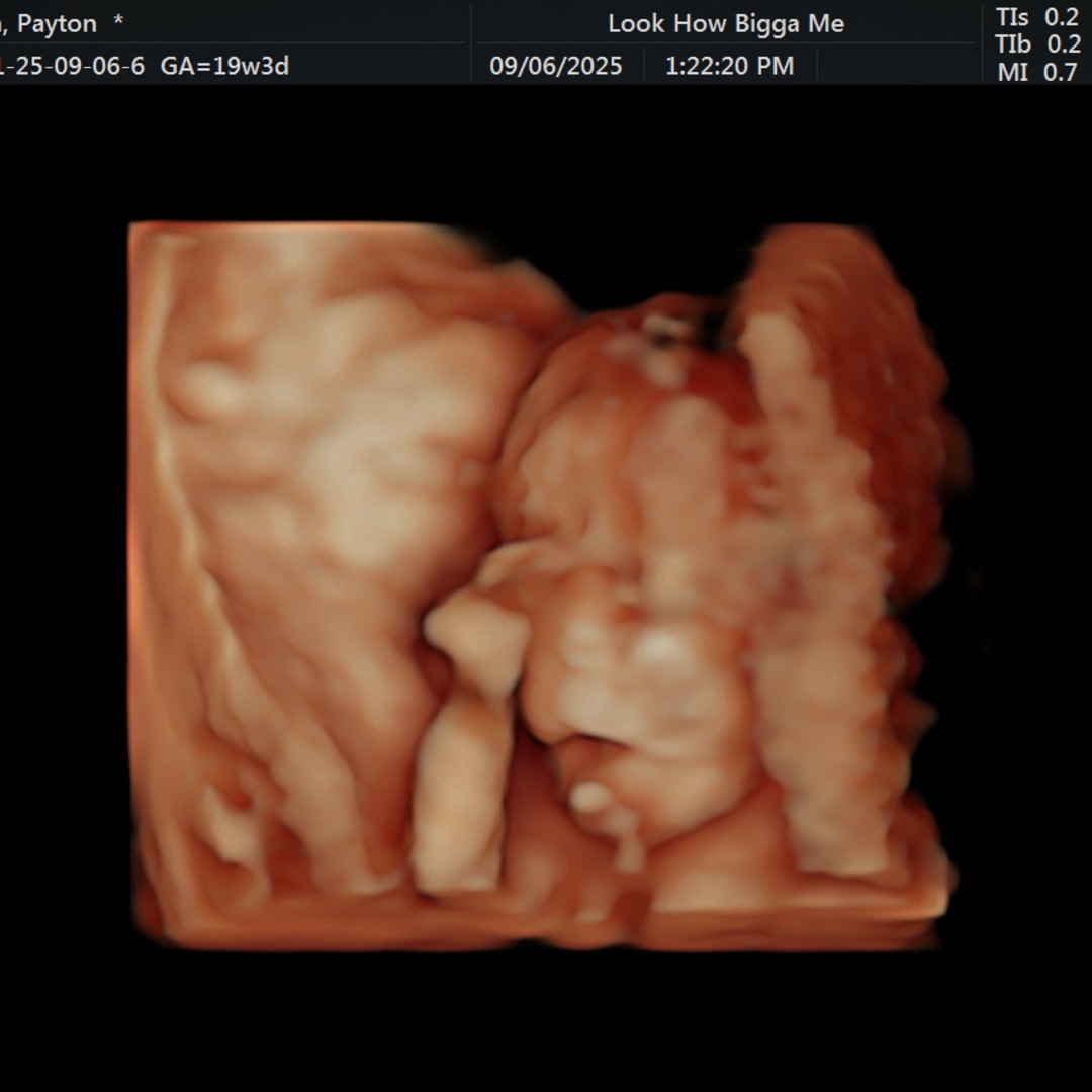 Photo shared by Payton for their Babylist baby registry.