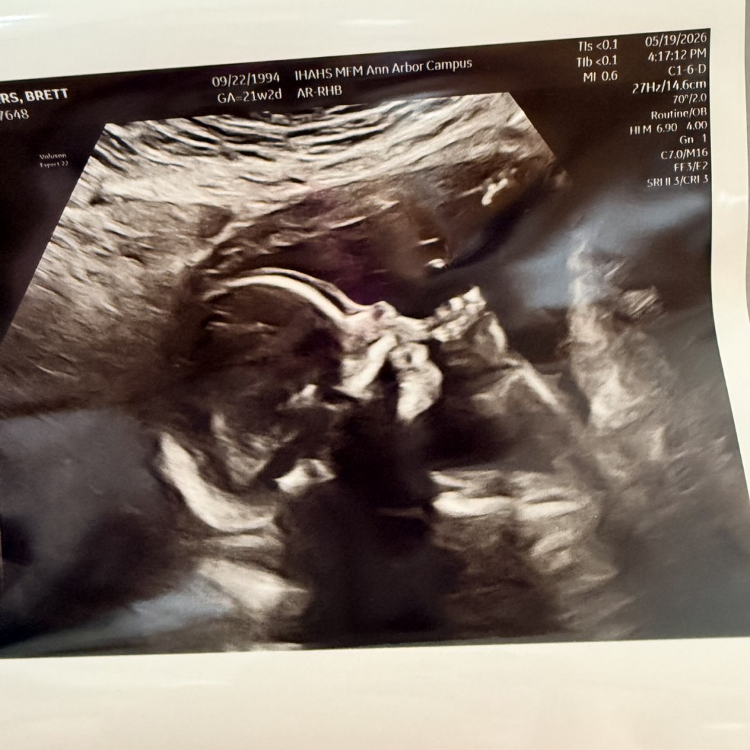 Photo shared by Brett for their Babylist baby registry.