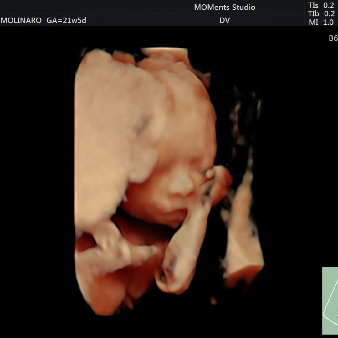 Photo shared by Emily for their Babylist baby registry.