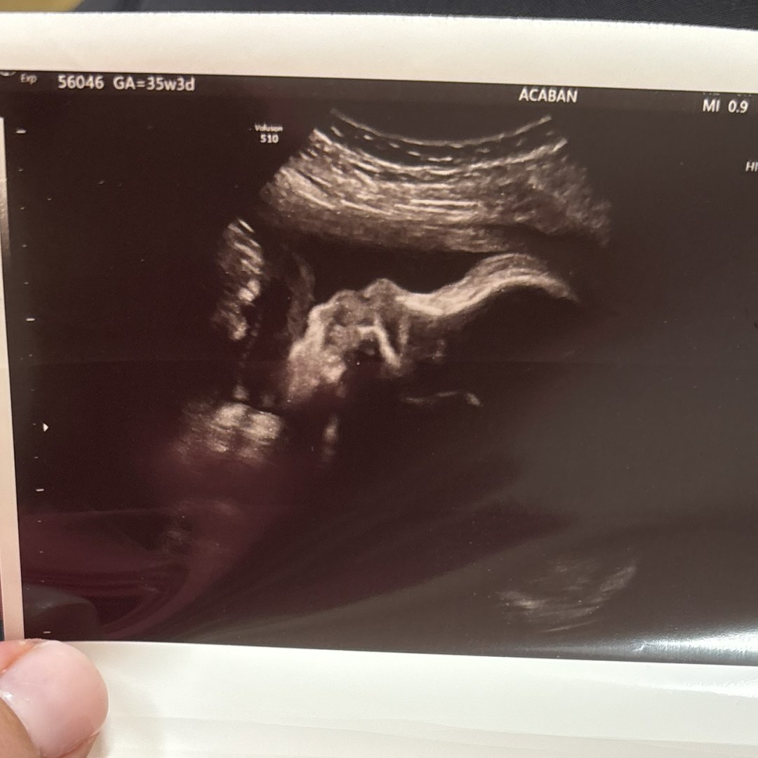 Photo shared by Ava for their Babylist baby registry.