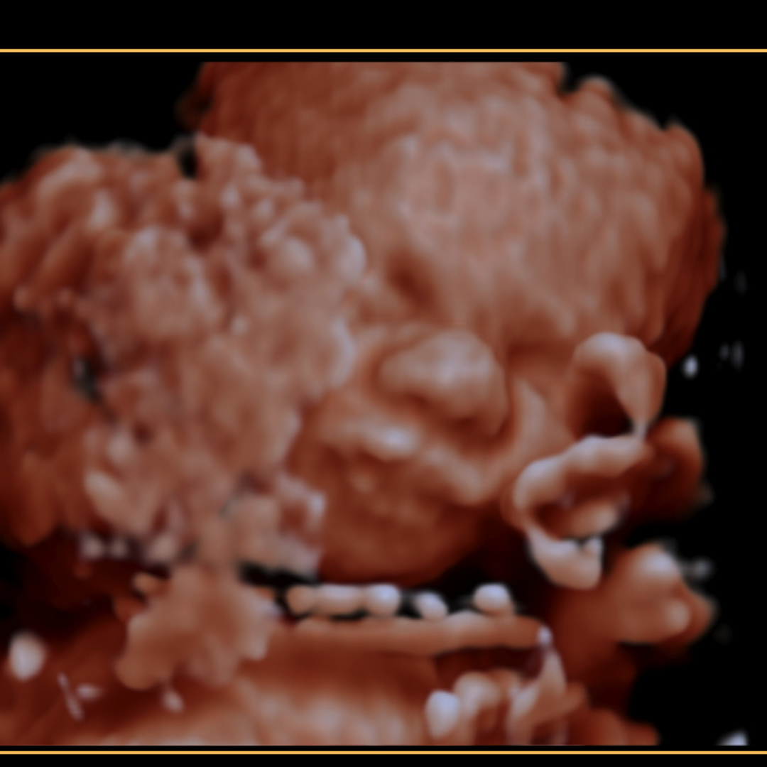 Photo shared by Emma for their Babylist baby registry.