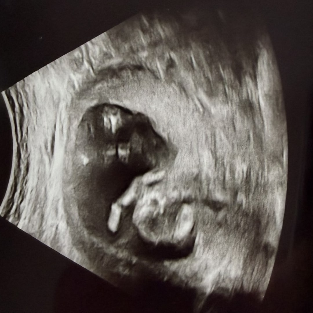 Photo shared by Kaitlynn for their Babylist baby registry.