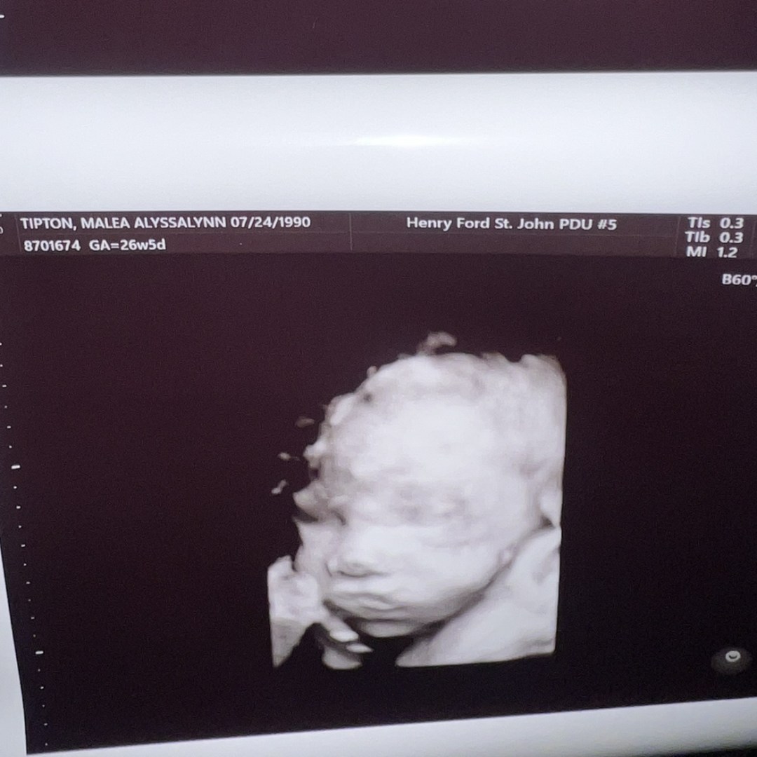 Photo shared by Malea for their Babylist baby registry.