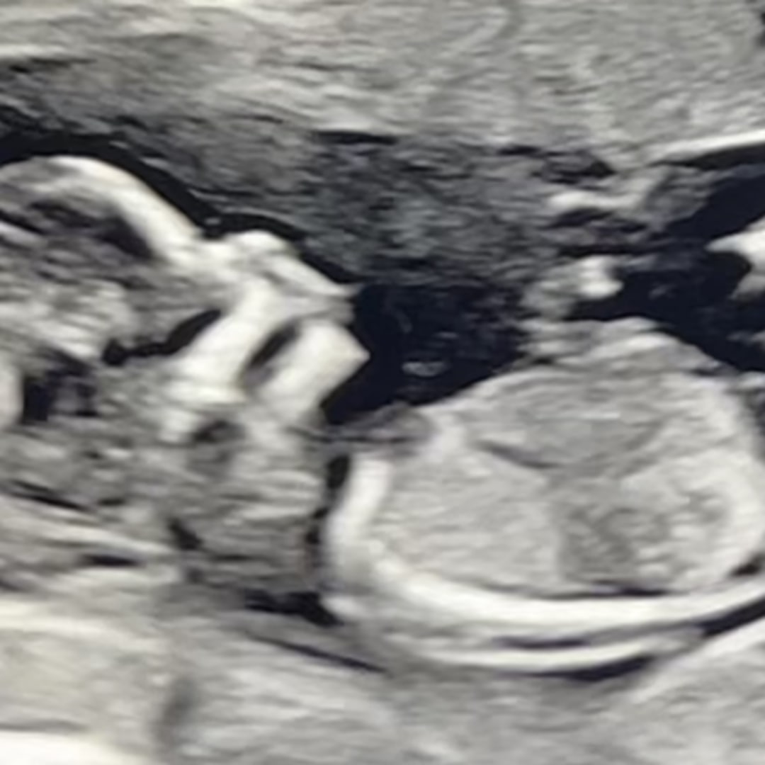 Photo shared by Luvinsky for their Babylist baby registry.