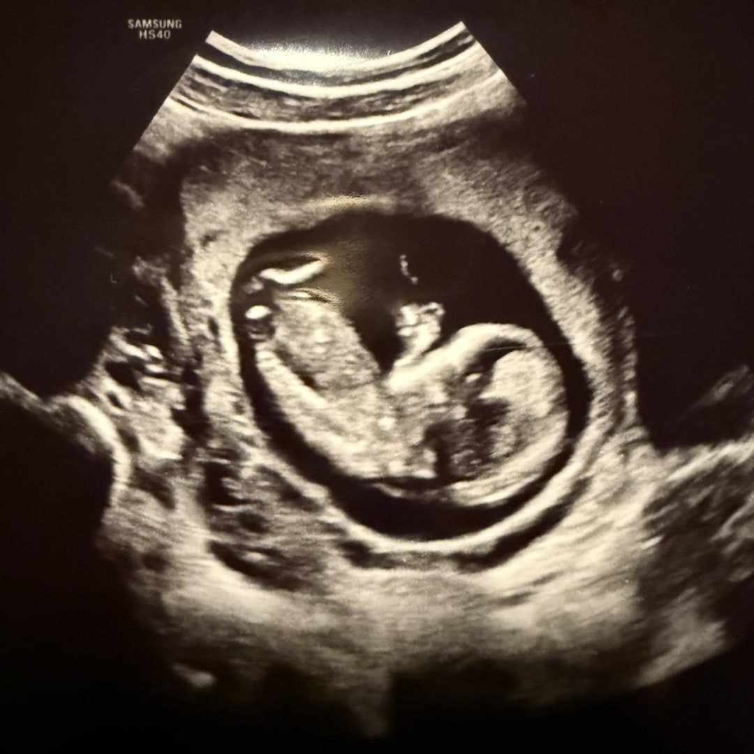 Photo shared by Jasmine for their Babylist baby registry.