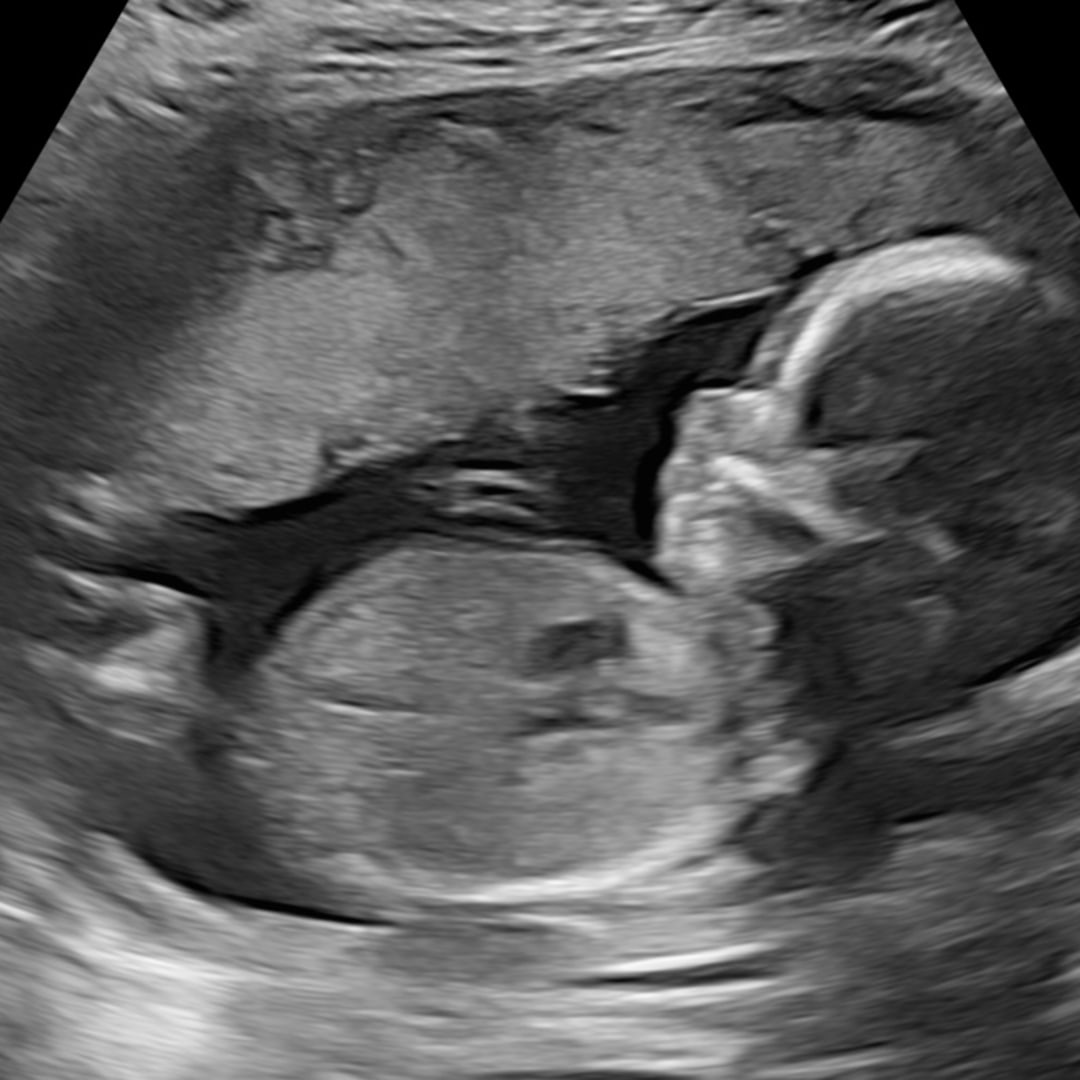Photo shared by Sarah for their Babylist baby registry.