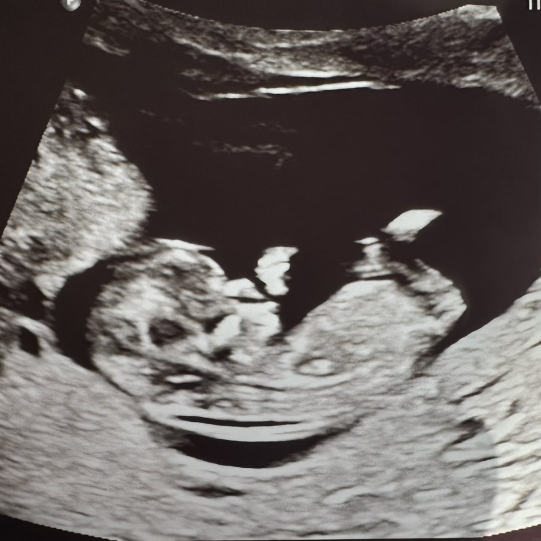 Photo shared by Amelia for their Babylist baby registry.