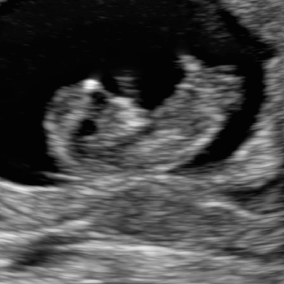 Photo shared by Marie for their Babylist baby registry.