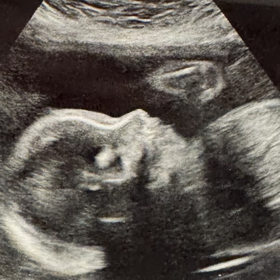 Photo shared by Rose for their Babylist baby registry.