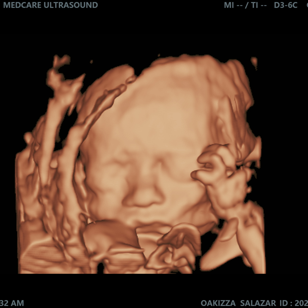Photo shared by Oakizza for their Babylist baby registry.