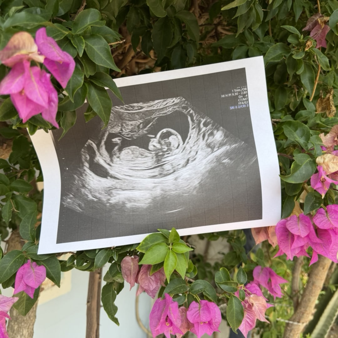 Photo shared by Canden for their Babylist baby registry.