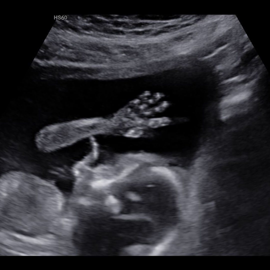 Photo shared by Gianna for their Babylist baby registry.