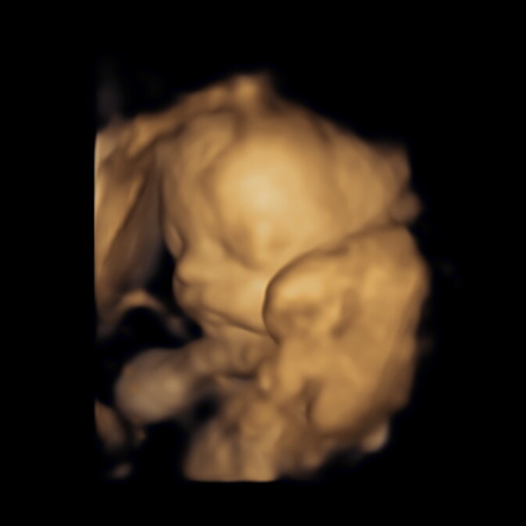 Photo shared by Caitlyn for their Babylist baby registry.