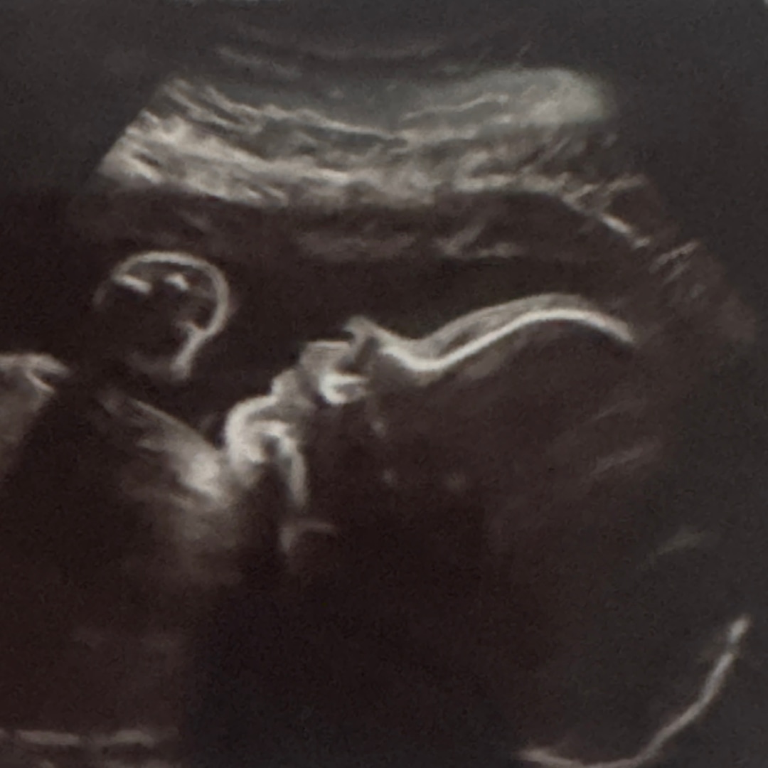 Photo shared by Grace for their Babylist baby registry.