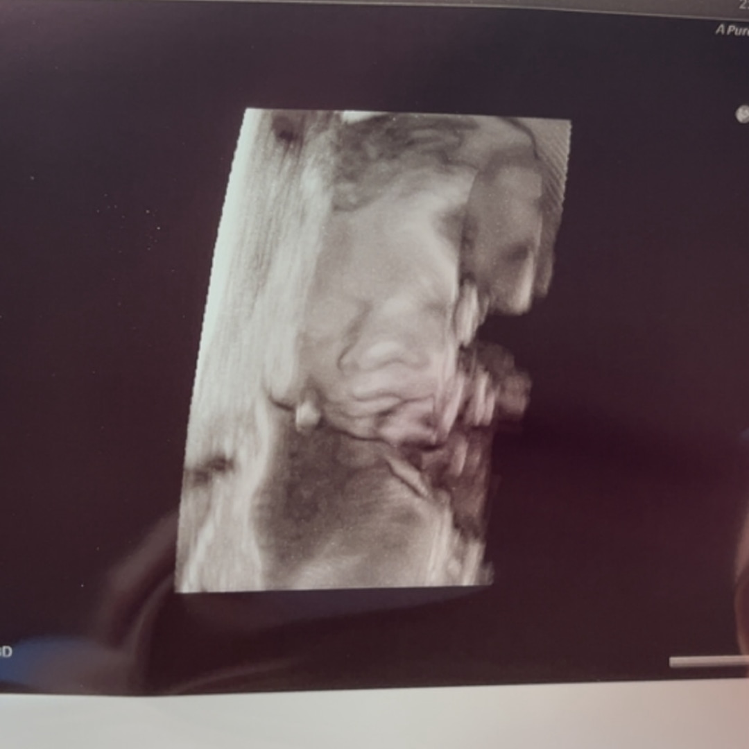 Photo shared by Kayla for their Babylist baby registry.