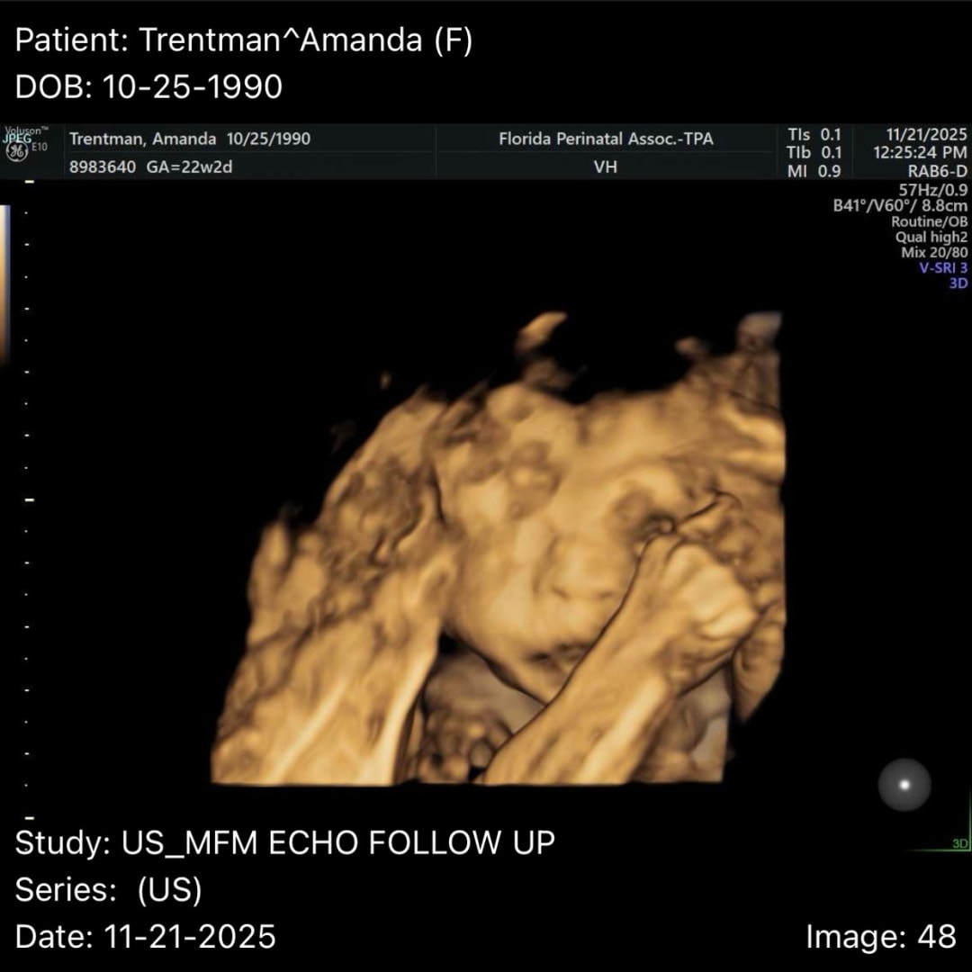 Photo shared by Amanda for their Babylist baby registry.