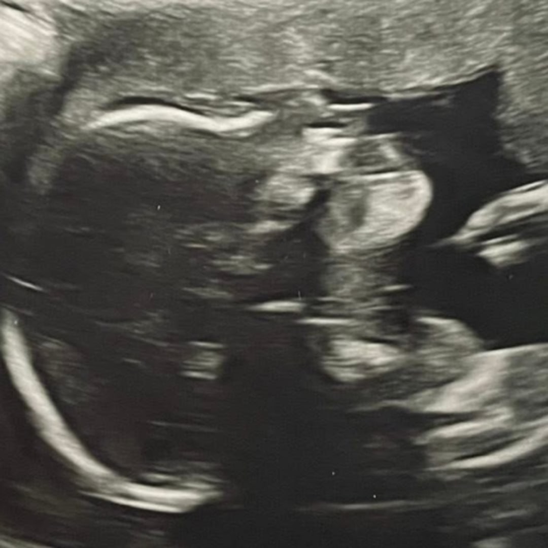 Photo shared by Tessa for their Babylist baby registry.