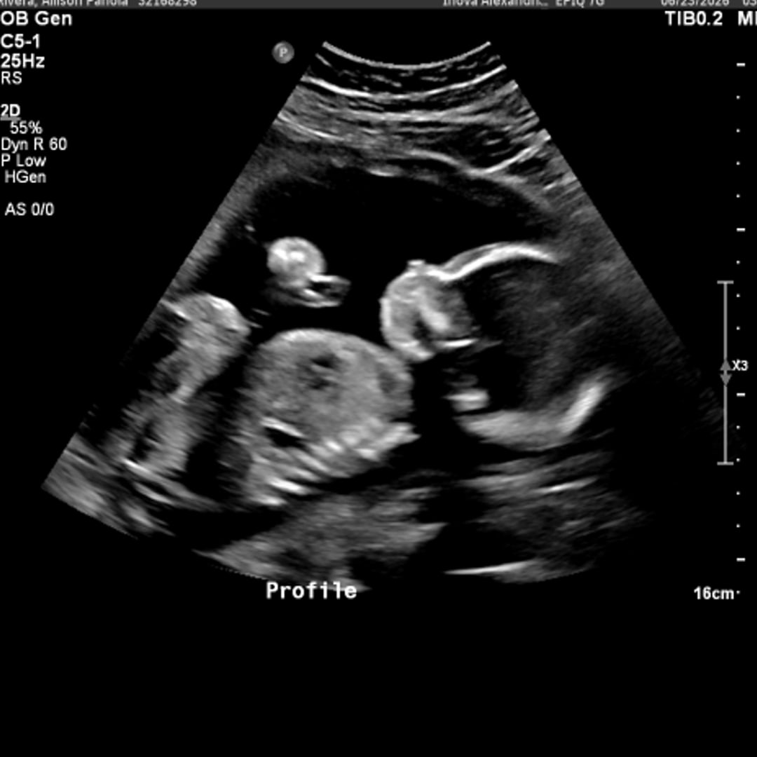 Photo shared by Allison for their Babylist baby registry.