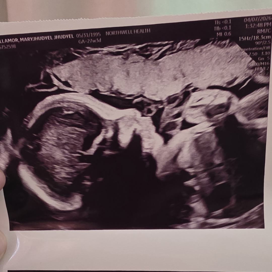 Photo shared by Mary for their Babylist baby registry.