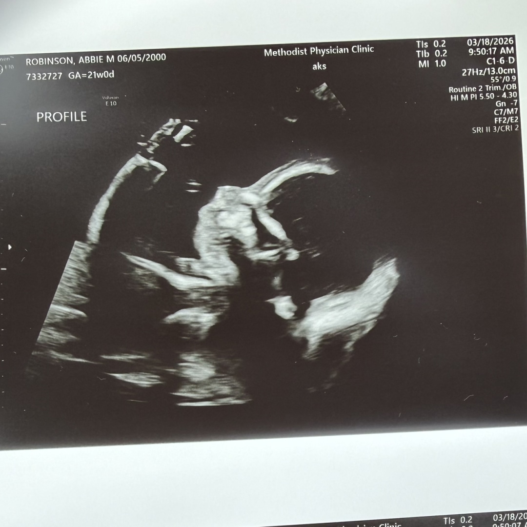 Photo shared by Abbie for their Babylist baby registry.