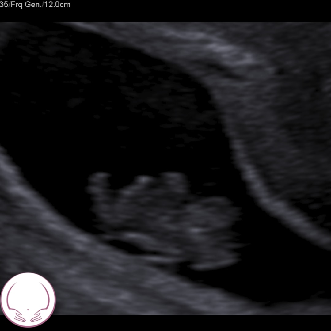 Photo shared by Eva for their Babylist baby registry.