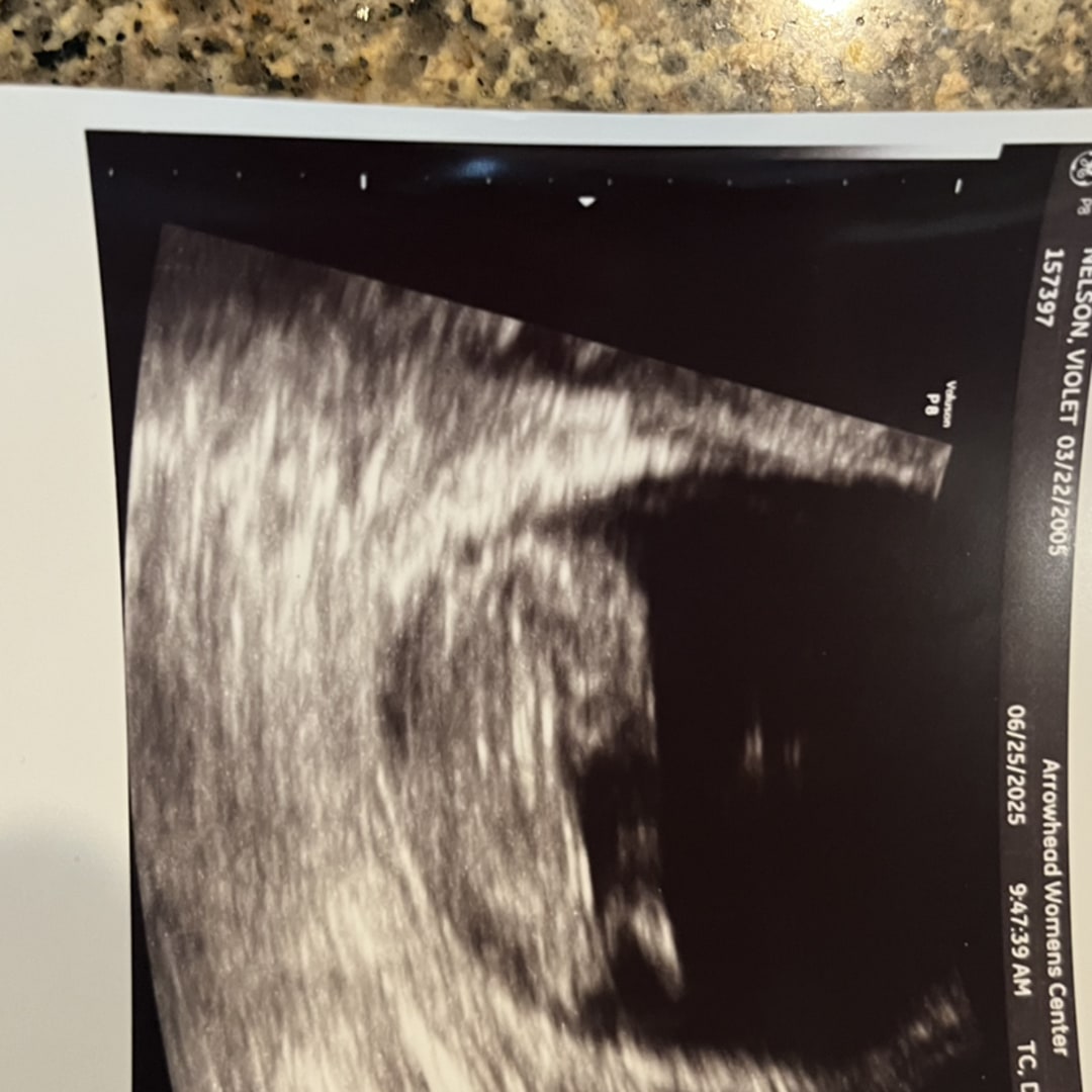 Photo shared by Violet for their Babylist baby registry.