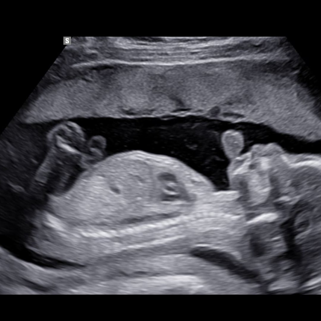 Photo shared by Monica for their Babylist baby registry.