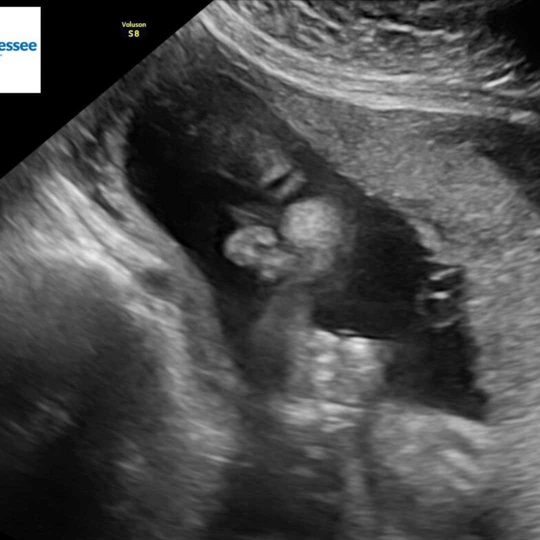 Photo shared by Layla for their Babylist baby registry.