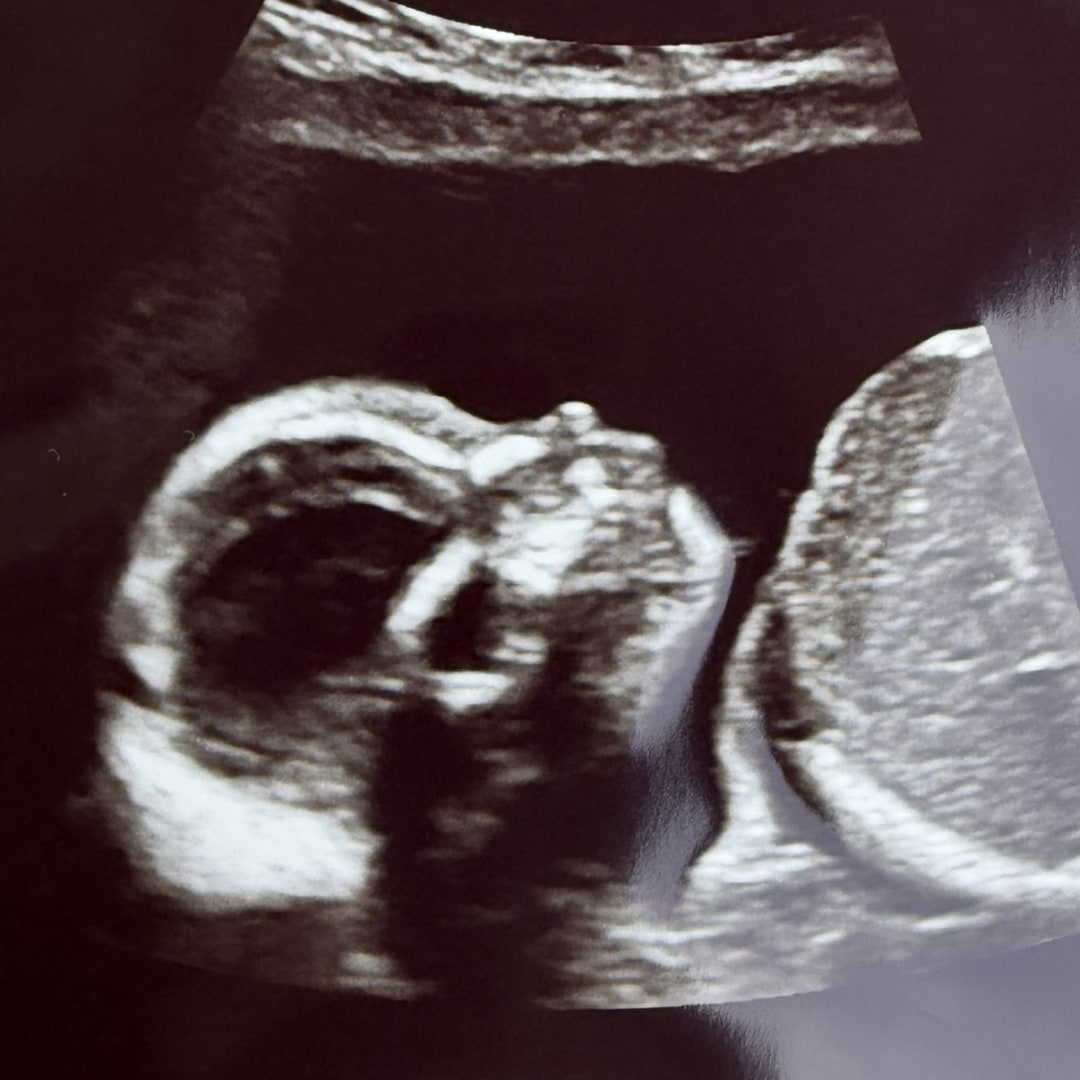 Photo shared by Rose for their Babylist baby registry.