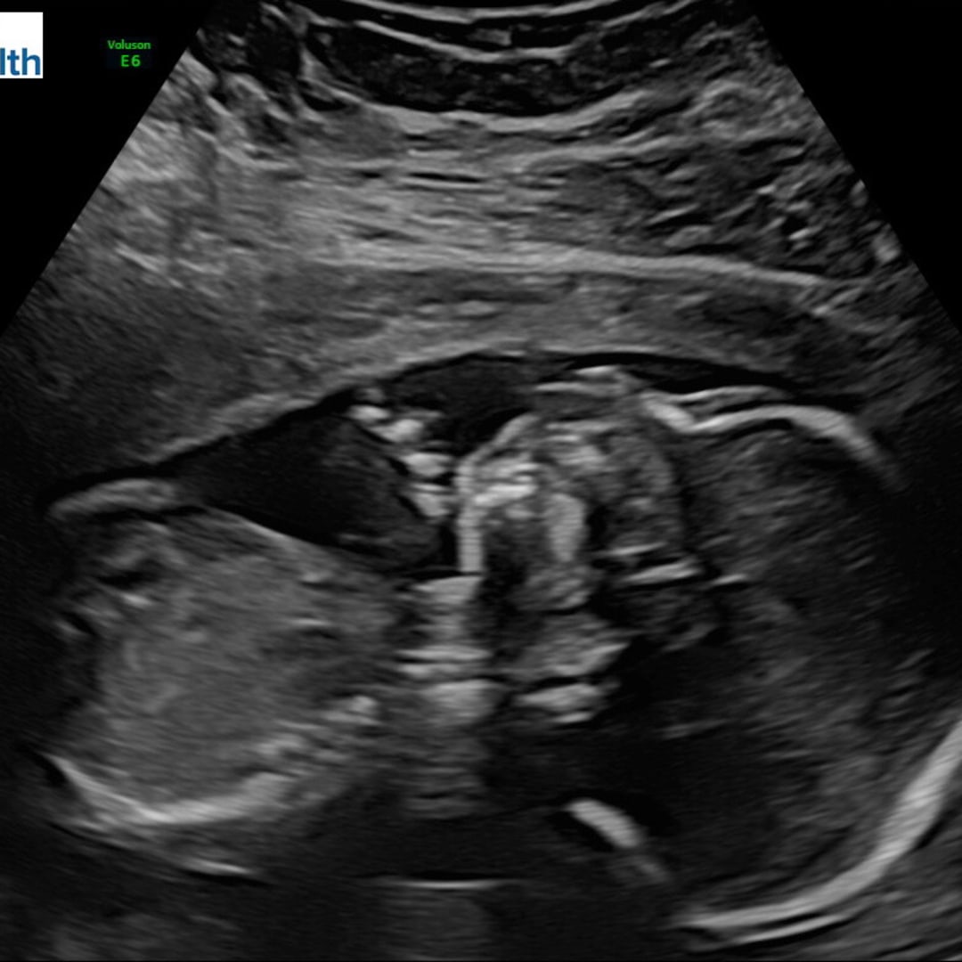 Photo shared by Becca for their Babylist baby registry.
